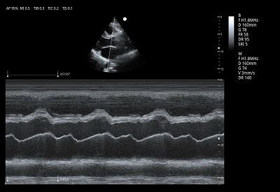 product-1-1 Cardiac M Mode(001)