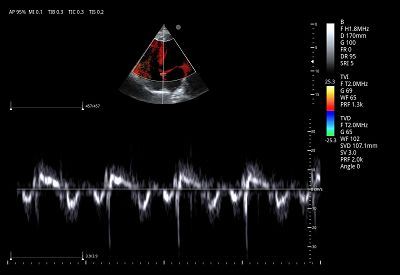product-1-1 TVI(001)