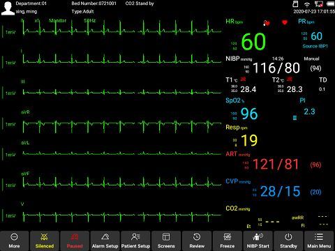 ECG Full Screen